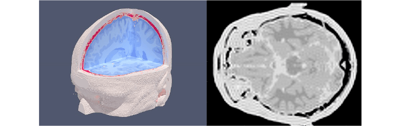 Ricostruzione numerica di immagini MRI di phantom digitali
